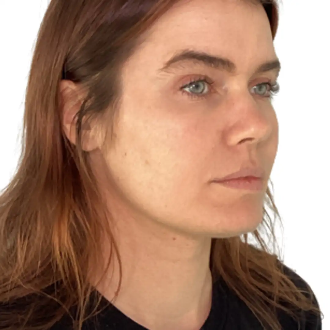 Beautiful Girl Right side Closeup image after Facial Treatment in Chesapeake, VA at Eluxir MD