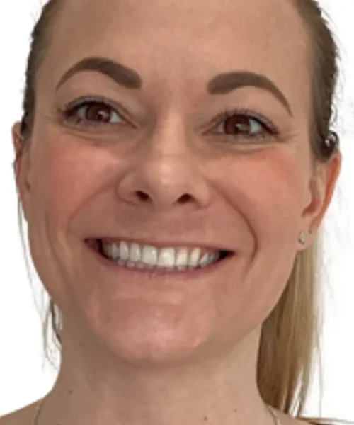 Before and after treatment results at EluxirMD in Chesapeake, VA, showing visible skin improvemen