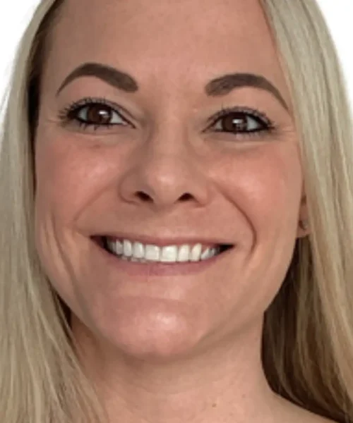 Twelfth Before and after Treatment Image of a Women at Eluxir MD in Chesapeake, VA