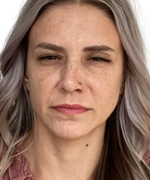 Before and after results from a skin rejuvenation treatment at EluxirMD in Chesapeake, VA