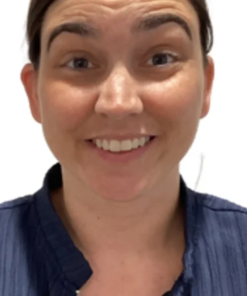 Visible transformation in before and after treatment photo at EluxirMD in Chesapeake, VA, highlighting enhanced skin appearance