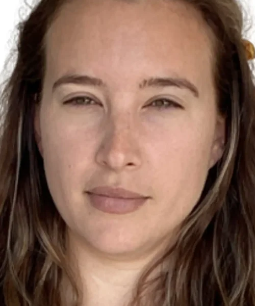 Before and after results at Eluxir MD in Chesapeake, VA, highlighting smoother skin