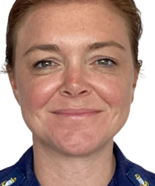 Before and after photo from Eluxir MD in Chesapeake, VA, demonstrating enhanced skin clarity and reduced fine lines following aesthetic treatment