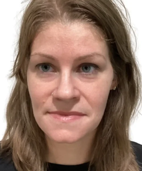 Before and after image from EluxirMD in Chesapeake, VA, showing noticeable improvement in skin firmness and texture after treatment